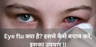 picture Eye and Eye Flu