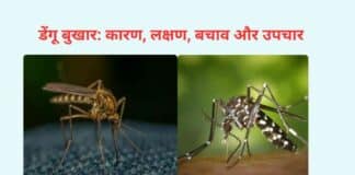 डेंगू बुखार: कारण, लक्षण, बचाव और उपचार | Dengue in hindi