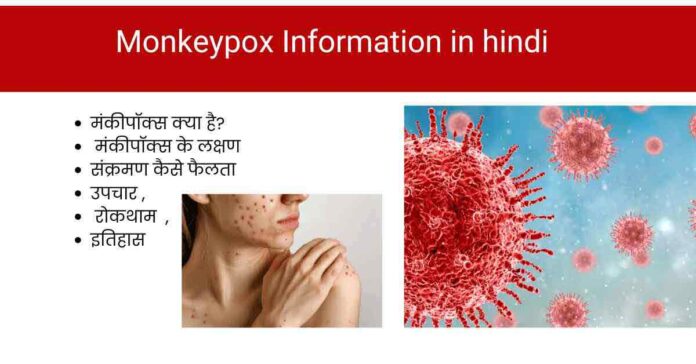 Monkeypox Information in hindi